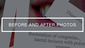 beforeafter