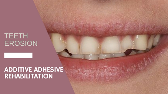 additive adhesive rehabilitation in erosion patient
