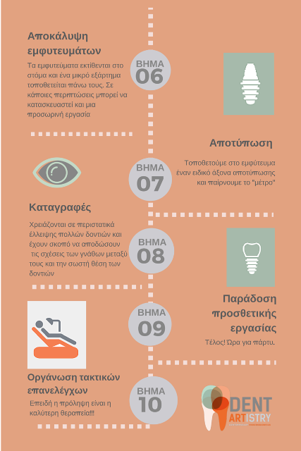 διαδικασία οδοντικών εμφυτευμάτων