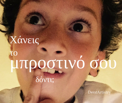 χάνεις το μπροστινό σου δόντι