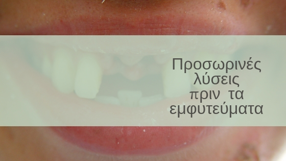 Προσωρινές λύσεις πριν τα εμφυτεύματα