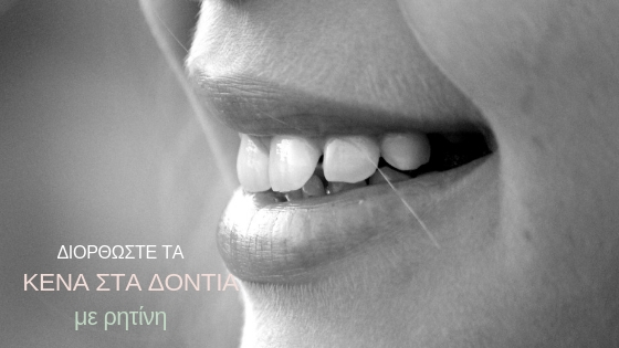 Διορθώστε τα κενά στα δόντια με σύνθετη ρητίνη