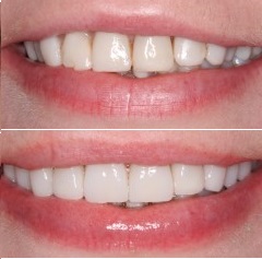 tribefore after